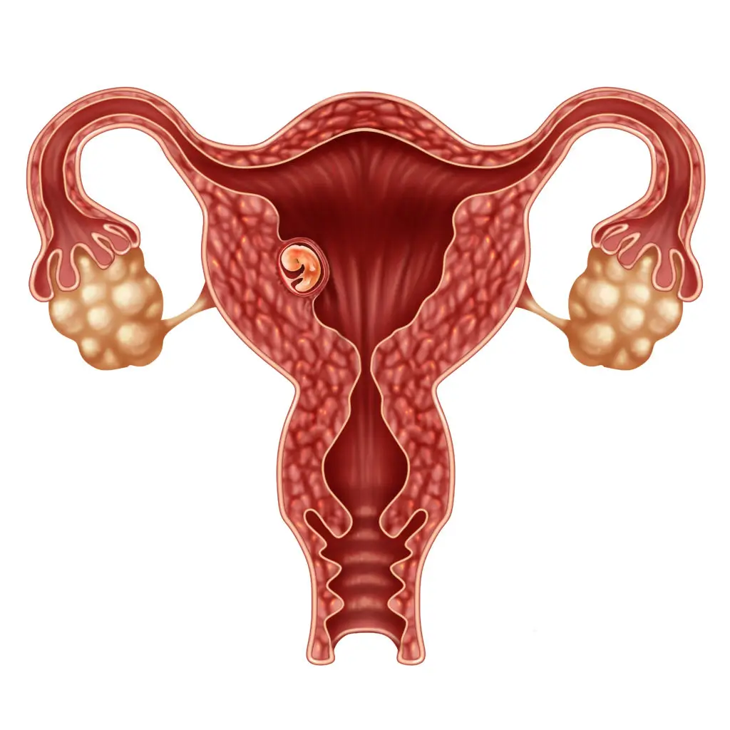 Endometrial Receptivity treatment in Chennai