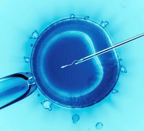 Intra Cytoplasmic Sperm Injection Treatment in Chennai