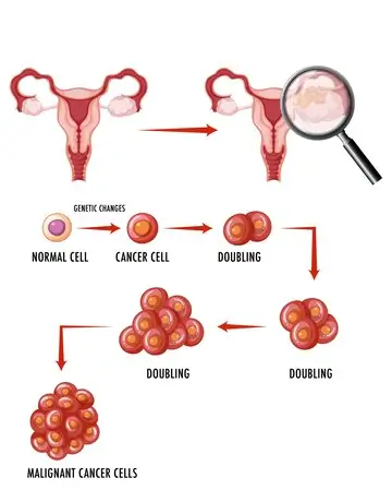 Oncofertility IVF Hospital in Chennai